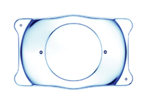 Implantable Contact Lens (ICL)